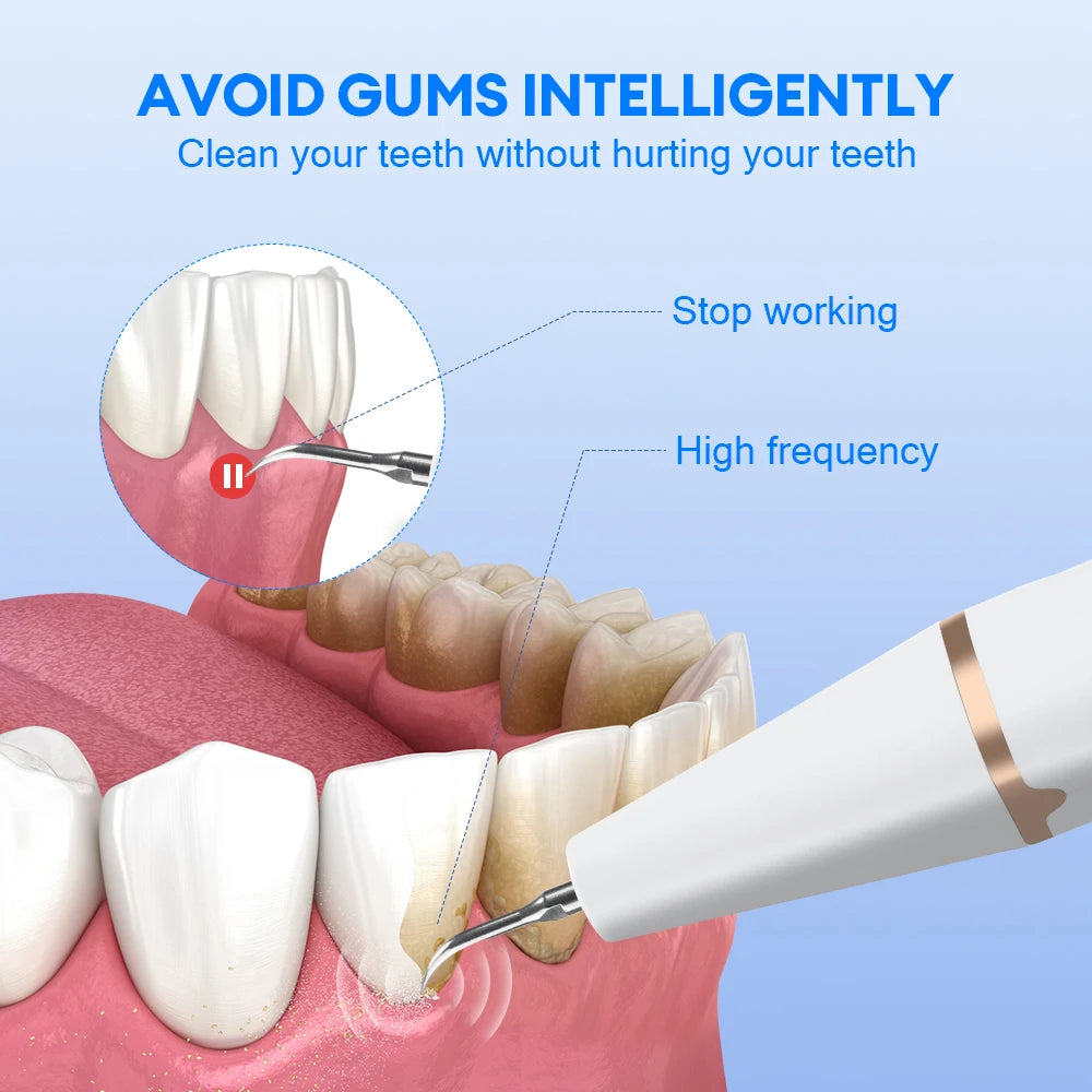 Ultrasonic Oral Care Wand