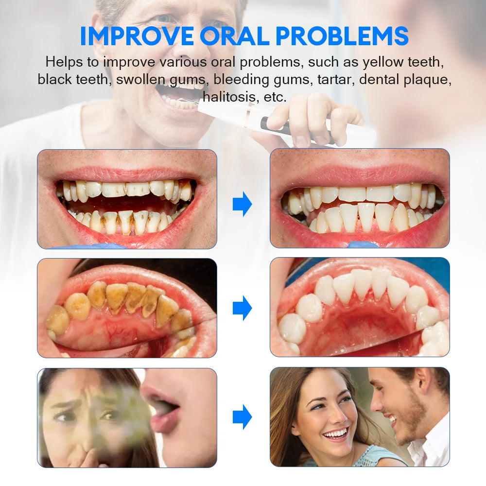 Ultrasonic Oral Care Wand