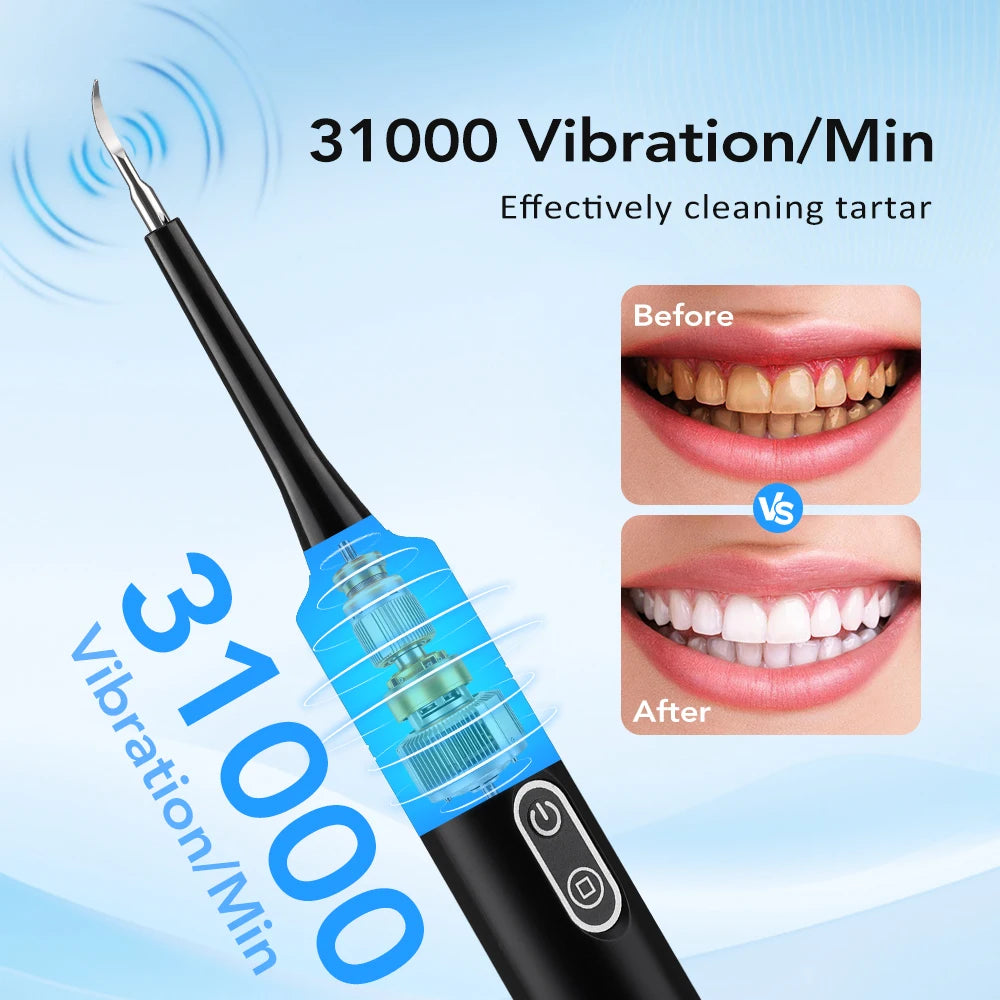 Precision Sonic Oral Care Wand