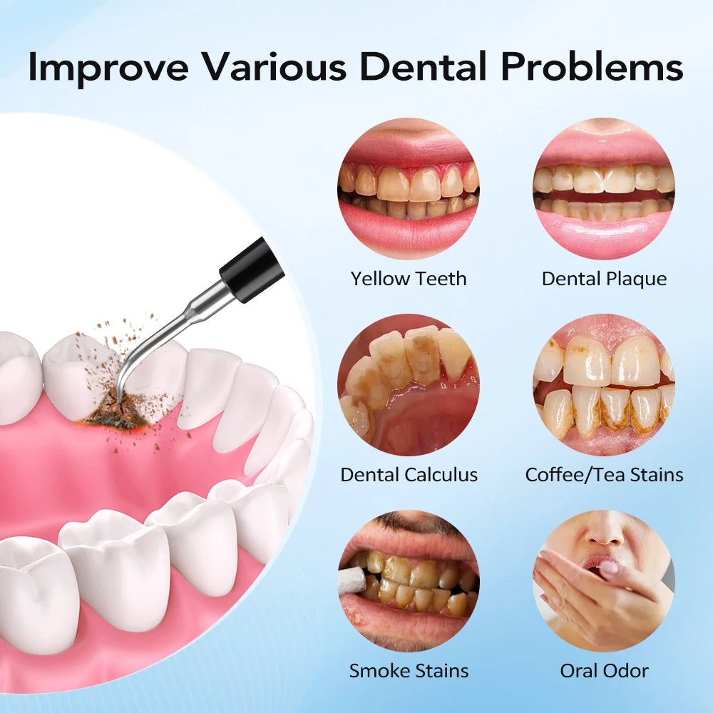 Precision Sonic Oral Care Wand